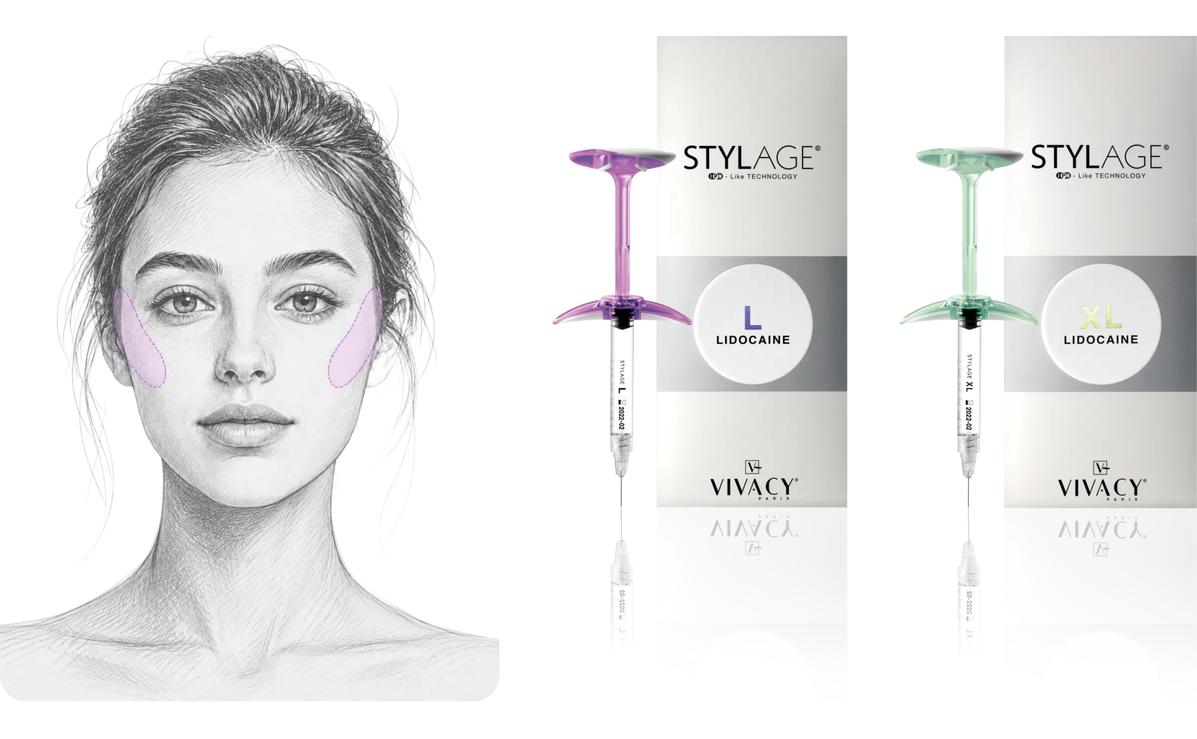 STYLAGE® L Lidocaine Bi-SOFT 시술 가이드