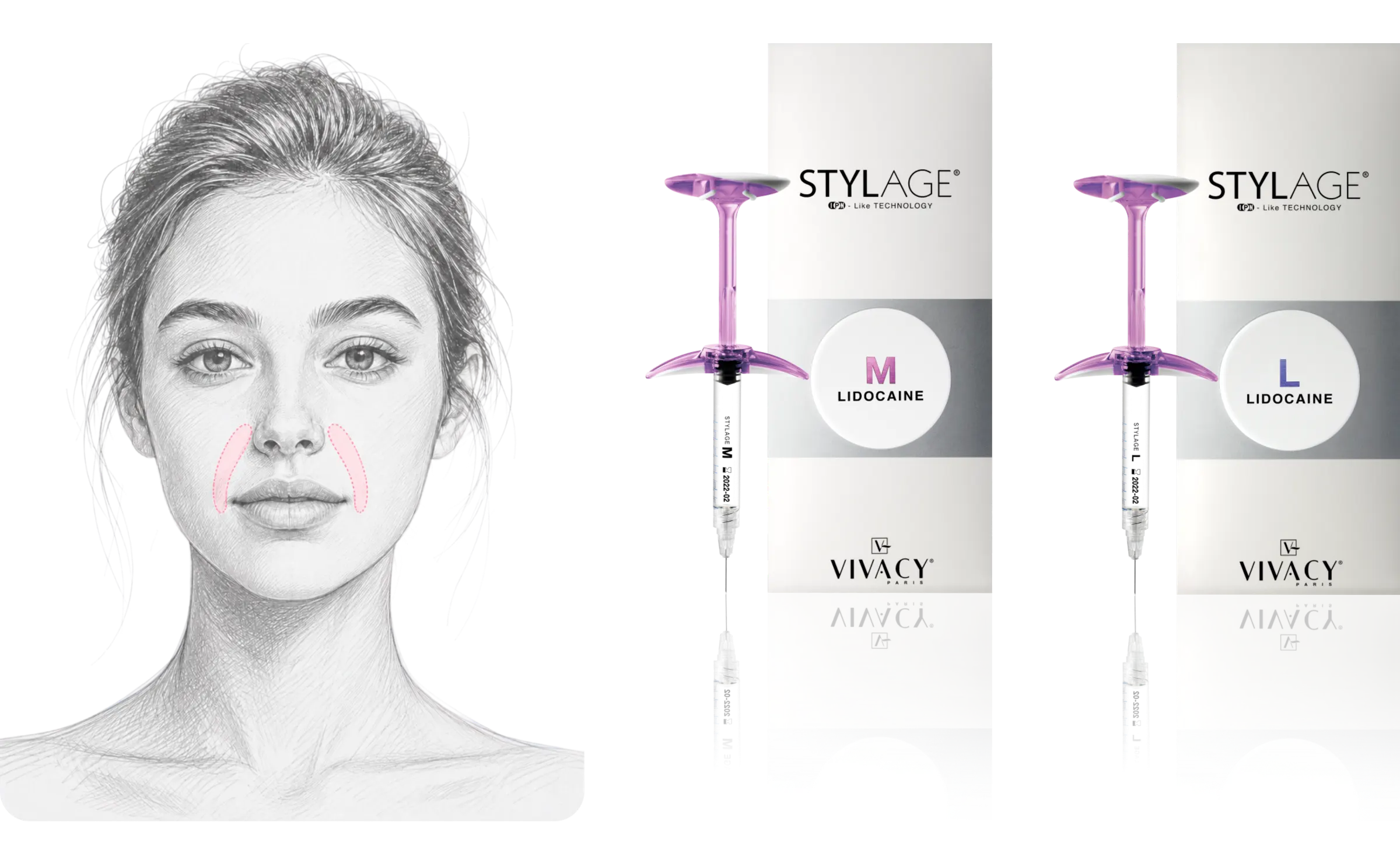STYLAGE® M Lidocaine Bi-SOFT 시술 가이드
