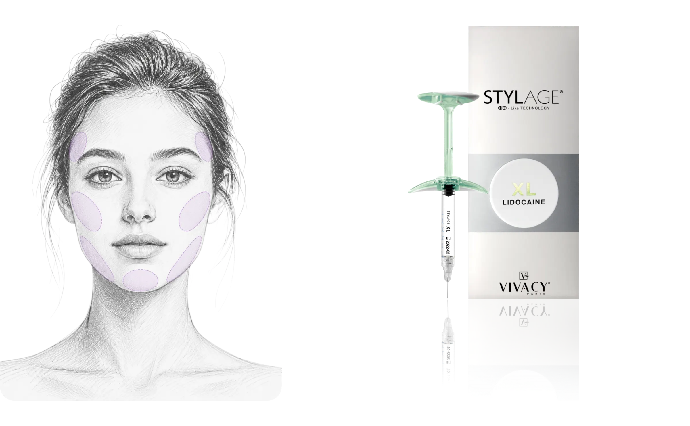 STYLAGE® XL Lidocaine Bi-SOFT 시술 가이드